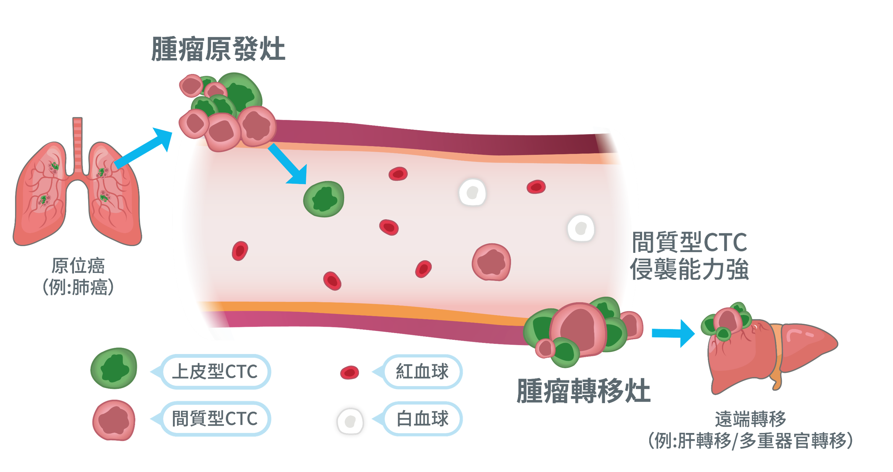 循環腫瘤細胞-癌症精準醫療檢測新趨勢