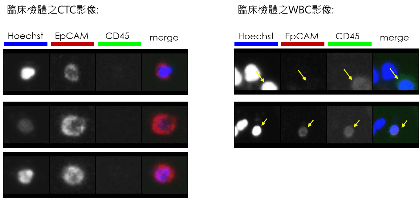 循環腫瘤細胞檢測報告局部範例，包含細胞影像與判讀區